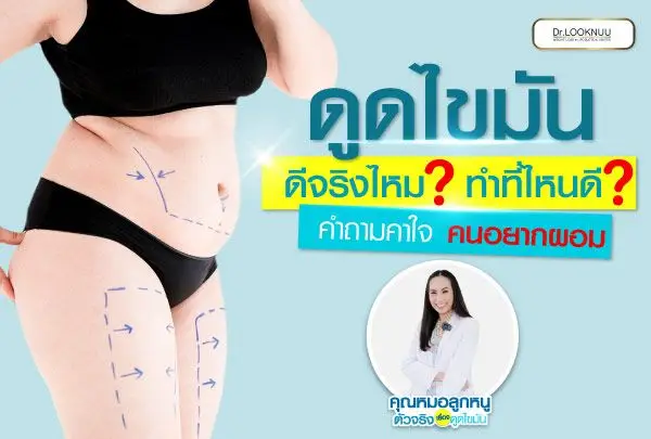 Where is the Best Place for Liposuction? What Should You Consider?