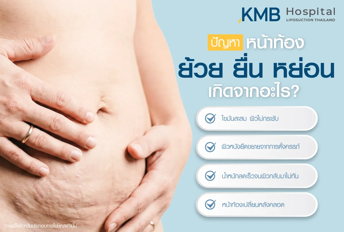 ปัญหาหน้าท้อง ย้วย ยื่น หย่อน เกิดจากอะไร