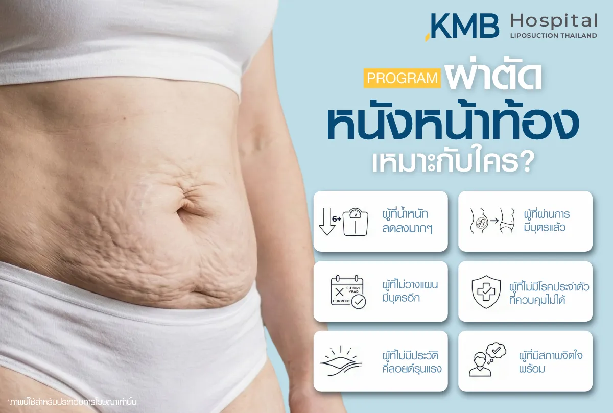 ผ่าตัดหนังหน้าท้องเหมาะกับใคร