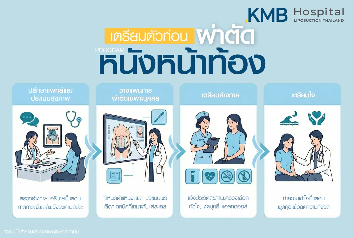 การเตรียมตัวก่อนผ่าตัดหนังหน้าท้อง