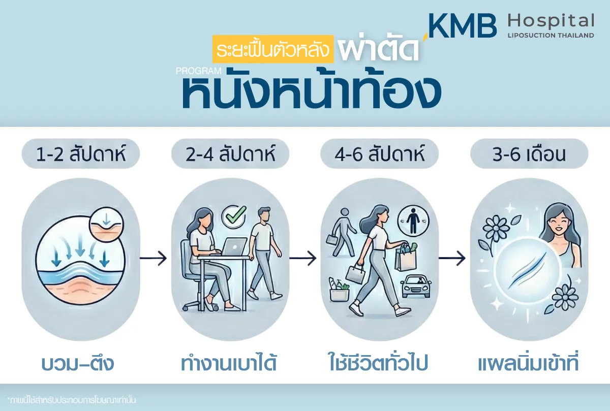 ระยะฟื้นตัวหลังผ่าตัดหนังหน้าท้อง