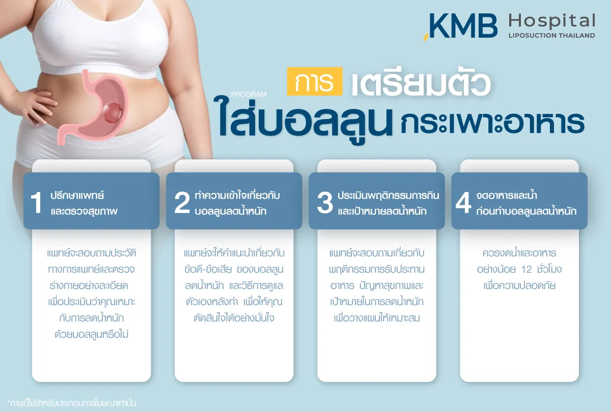 การเตรียมตัวสำหรับใส่บอลลูนกระเพาะอาหาร