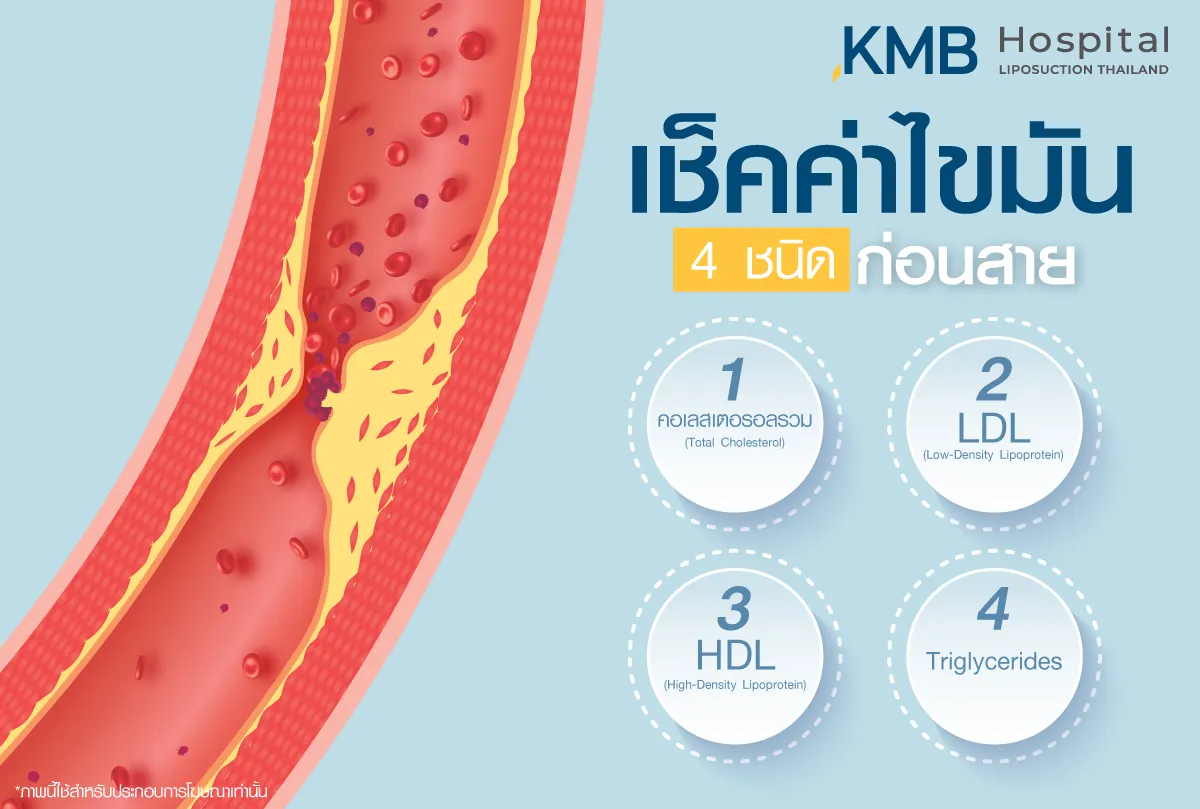 เชคค่าไขมัน 4 ชนิด ก่อนสาย