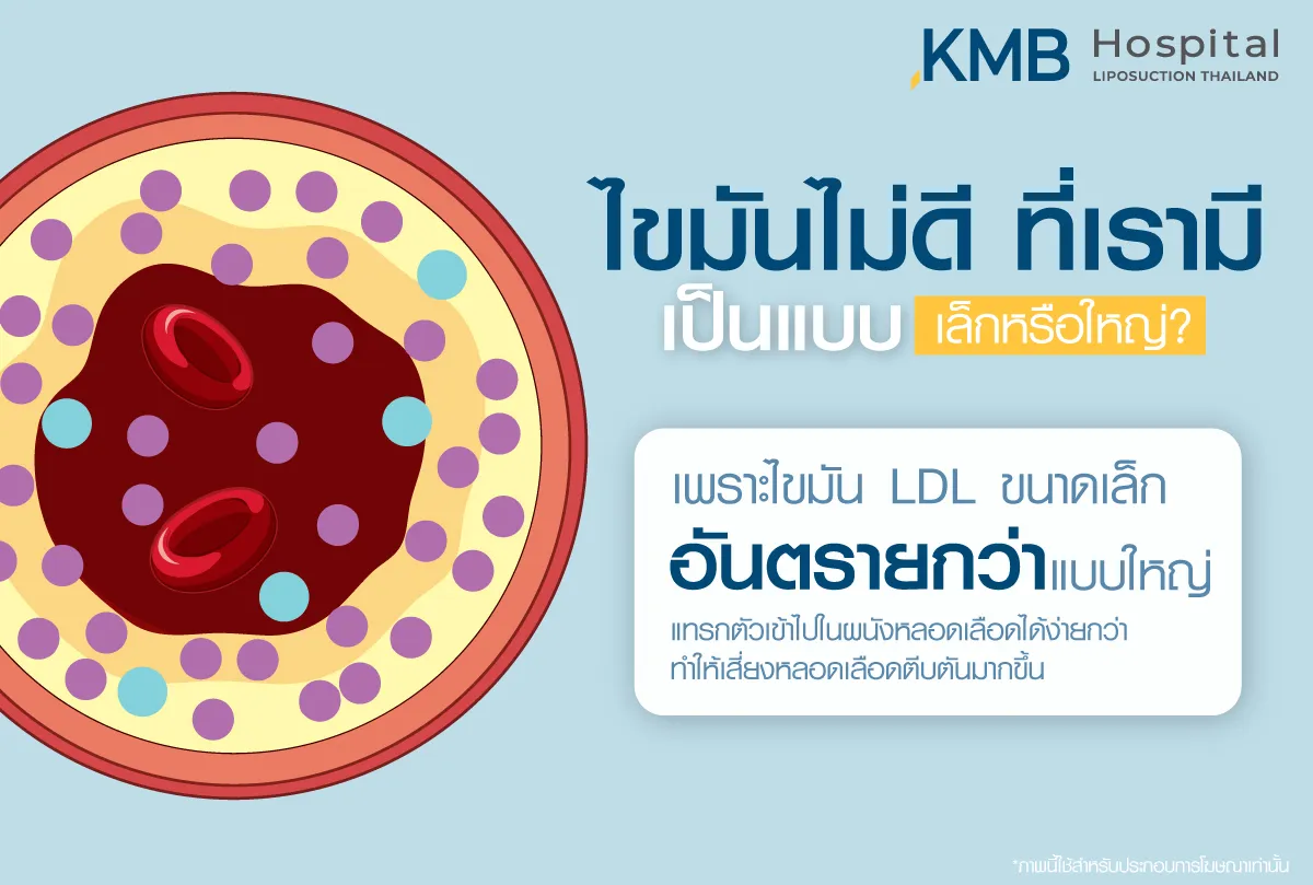 ไขมันไม่ดี ที่เรามี