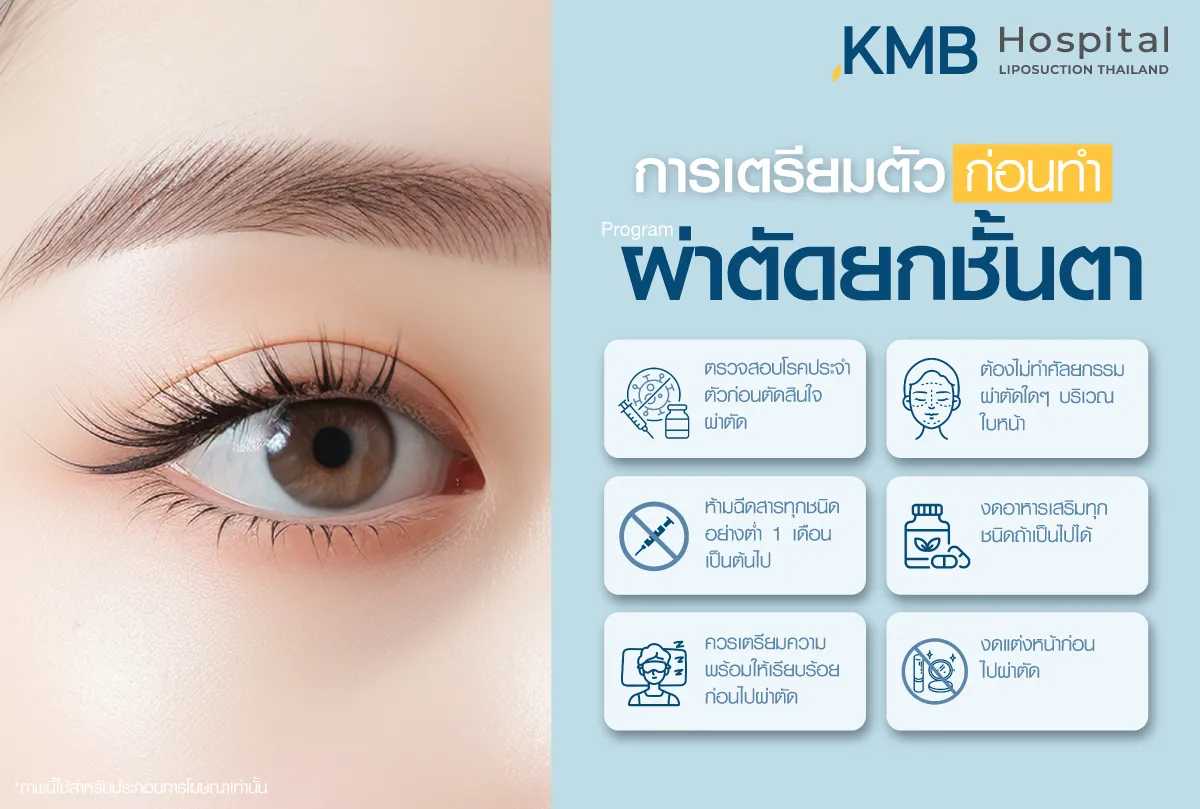 การเตรียมตัวก่อนผ่าตัดยกชั้นตา