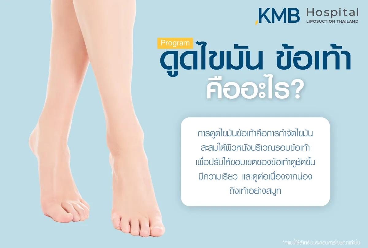 ดูดไขมันข้อเท้าคืออะไร