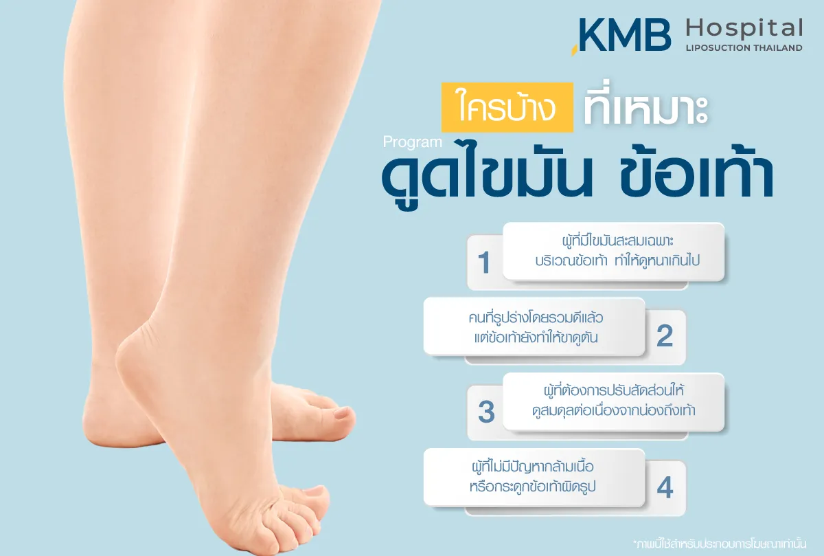 ใครบ้างที่เหมาะกับโปรแกรมดูดไขมันข้อเท้า