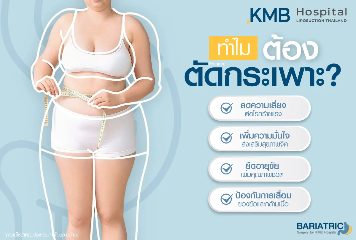 ทำไมต้องตัดกระเพาะ - kmb hospital