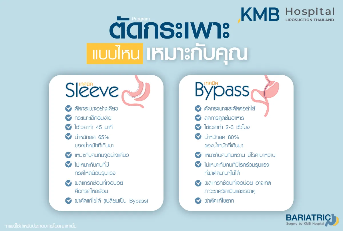 ตัดกระเพาะ แบบไหน ที่เหมาะ - kmb hospital - หมอลูกหนู