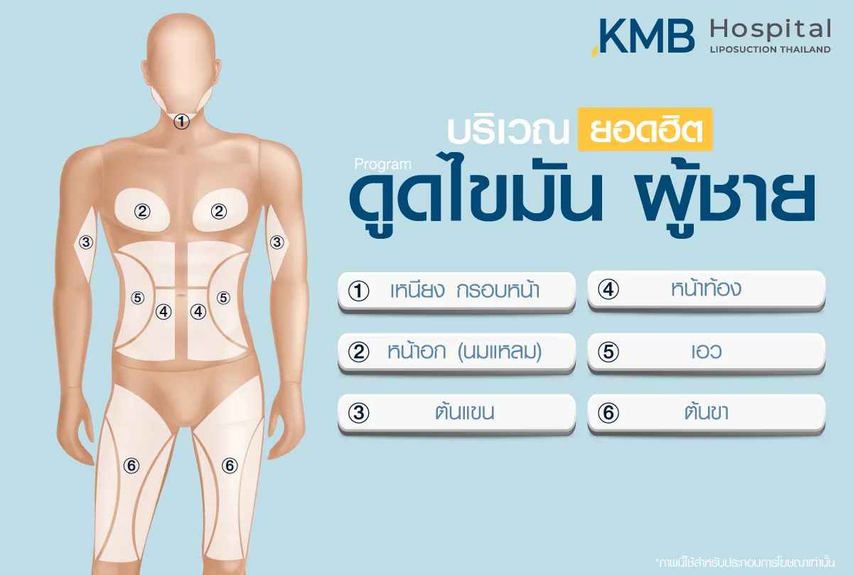 ดูดไขมันผู้ชาย - kmb hospital - หมอลูกหนู