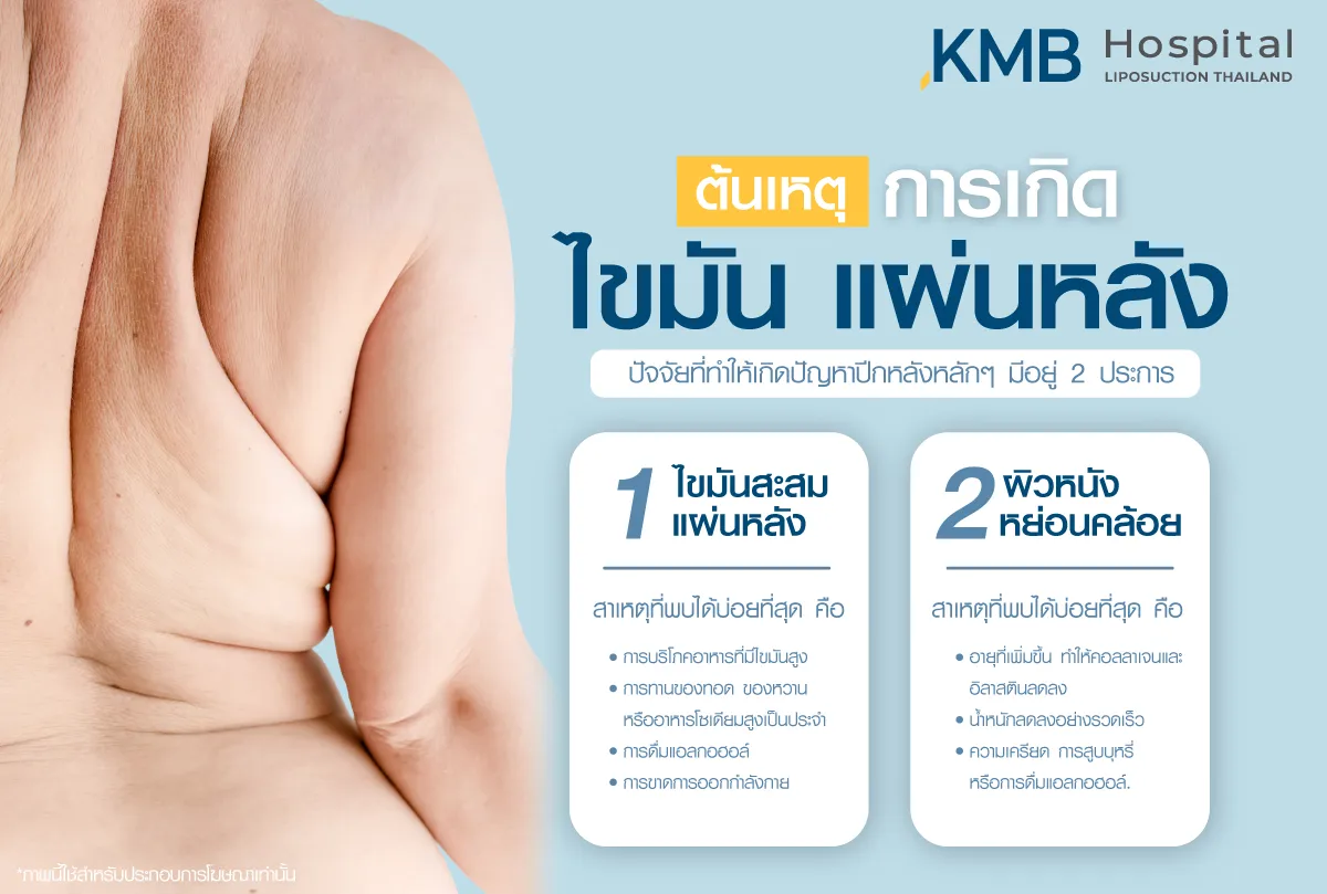 สาเหตุไขมันแผ่นหลัง - kmb hospital -หมอลูกหนู