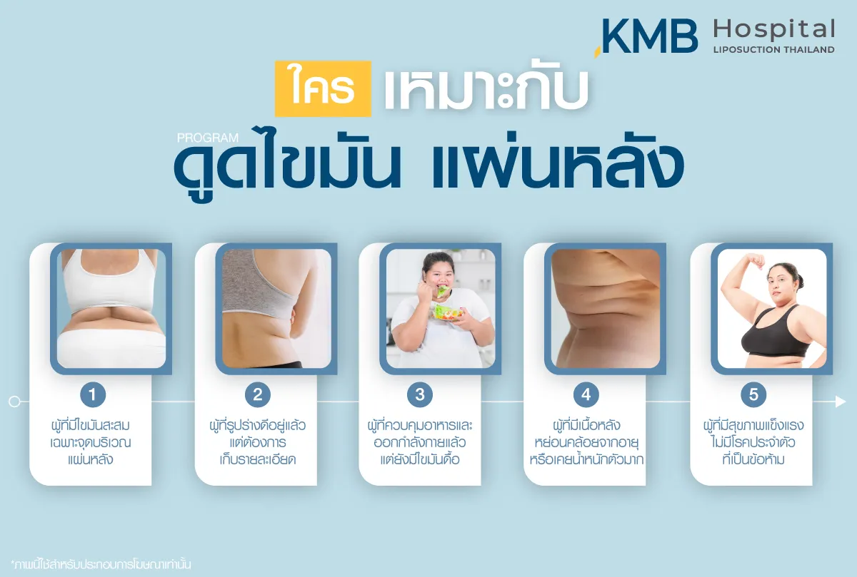 ดูดไขมันแผ่นหลังเหมาะกับใครบ้าง - kmb hospital