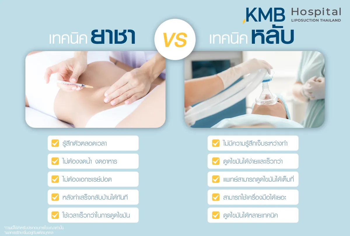 ดูดไขมันเลือกยาชาหรือยาสลบ- kmb hospital