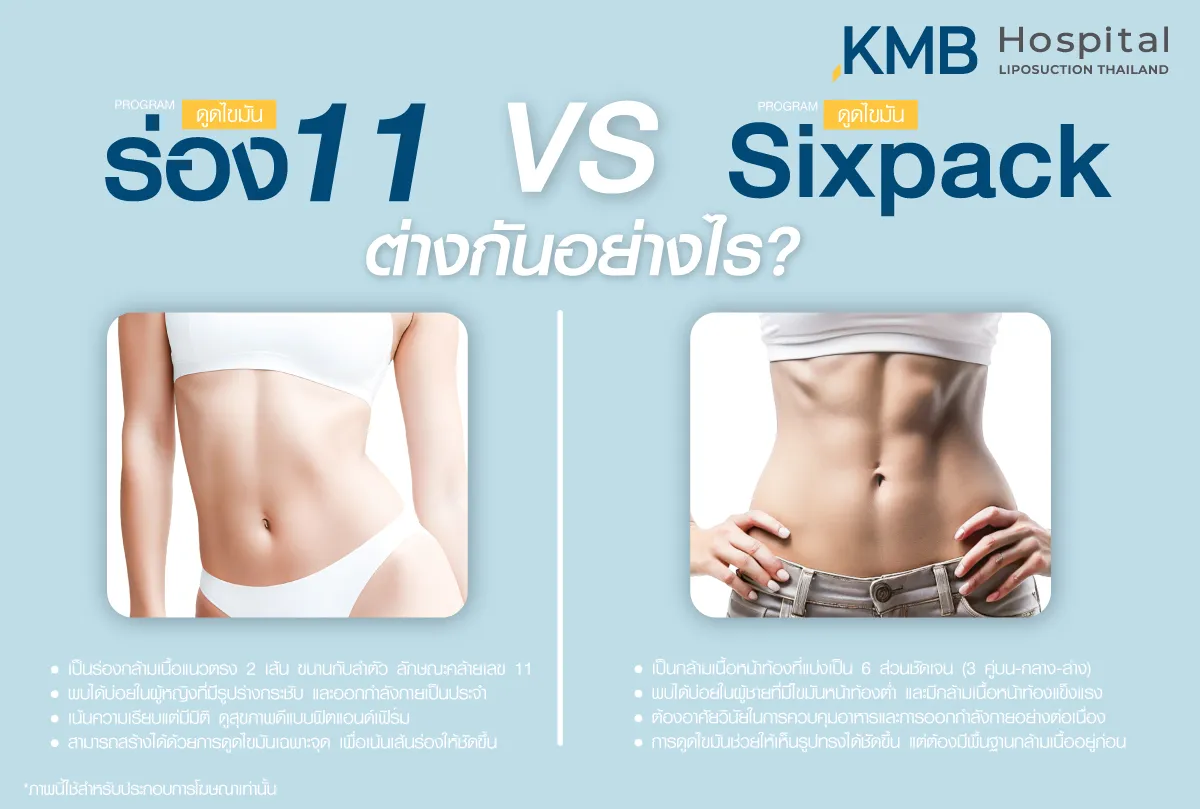 ความแตกต่างของ sexy line กับ six pack - kmb hospital - หมอลูกหนู