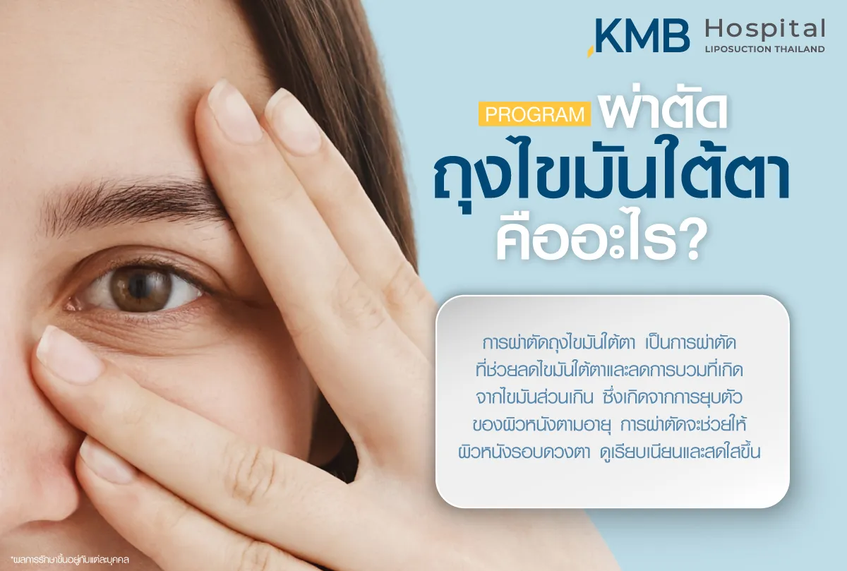 ผ่าตัดถุงไขมันใต้ตาคืออะไร - kmb hospital - หมอลูกหนู