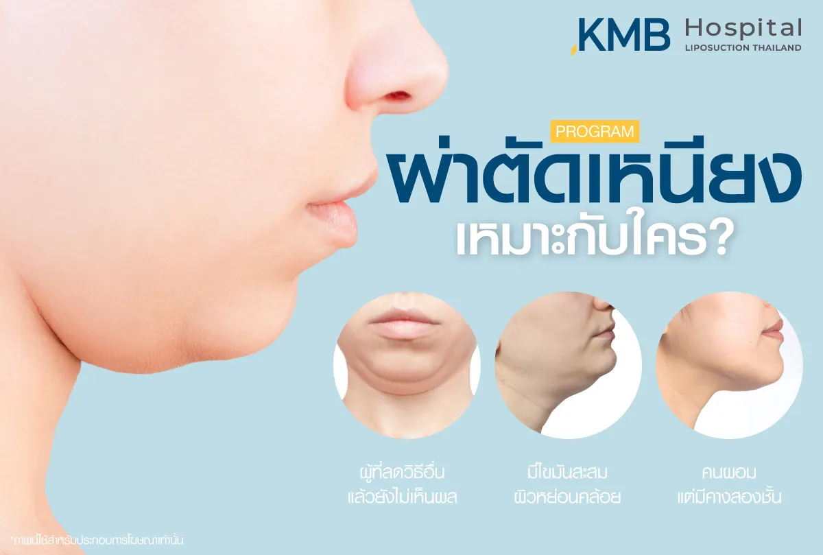 ผ่าตัดเหนียง เหมาะกับใคร - KMB Hospital