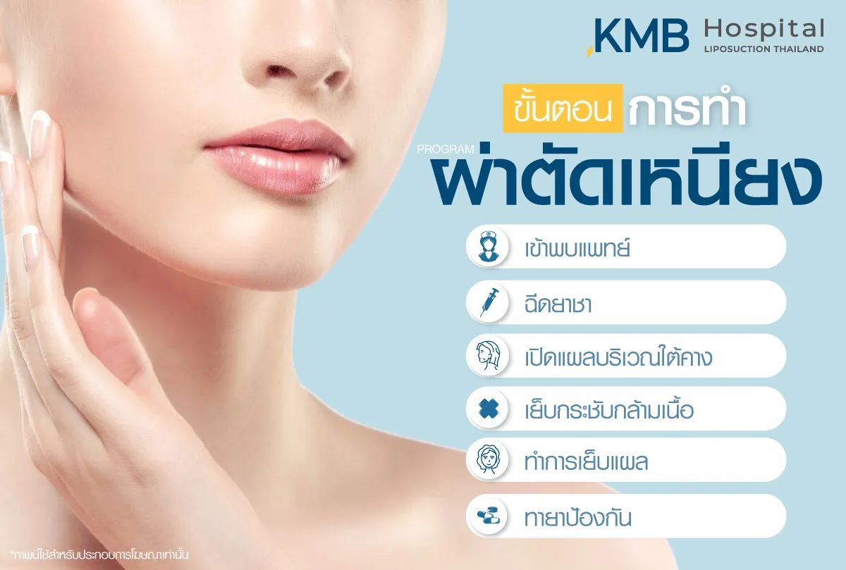 ขั้นตอนการผ่าตัดเหนียง - kmb hospital