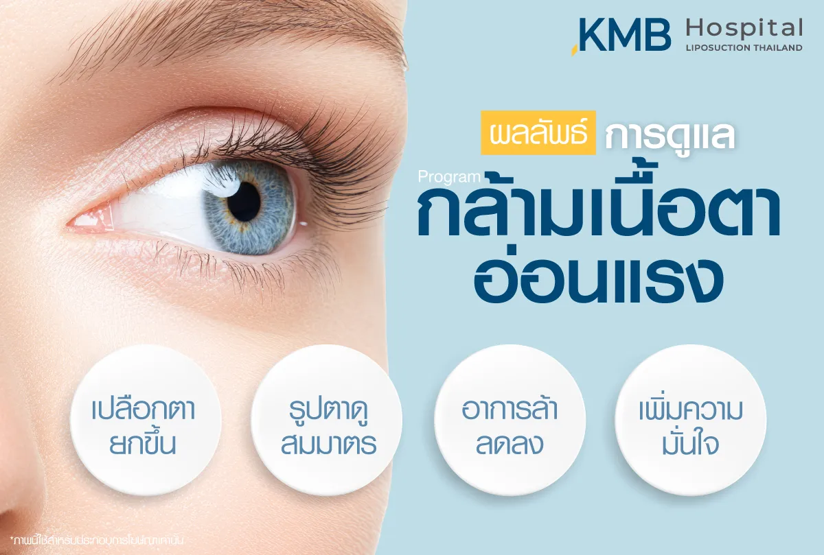 ผลลัพธ์การดูแล กล้ามเนื้อตาอ่อนแรง - kmb hospital