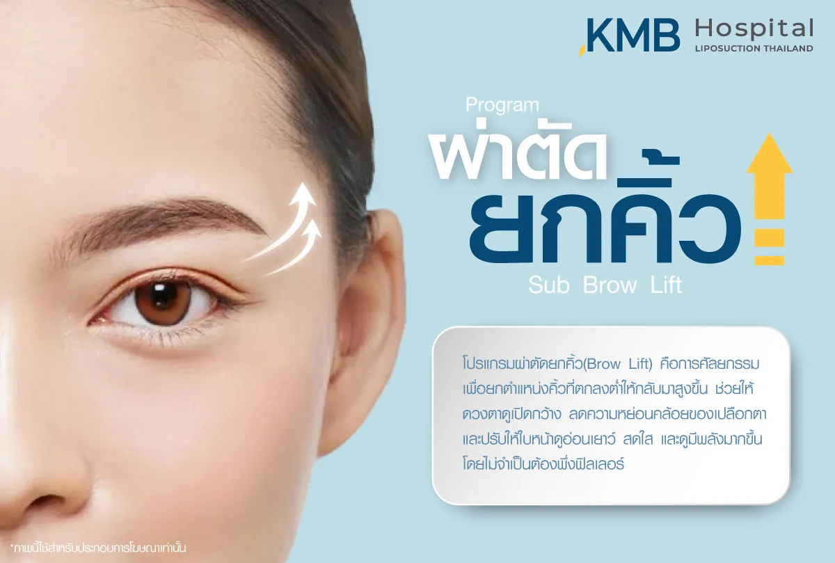 ผ่าตัดยกคิ้ว- kmb hospital