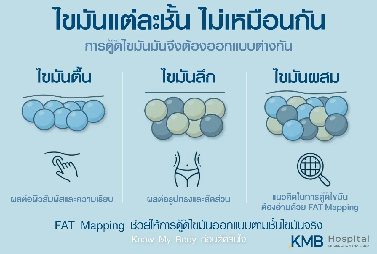 ภาพแพทย์ KMB Hospital อธิบายชั้นไขมันและแนวทางการดูแลแก่ผู้รับบริการ เพื่อช่วยให้เข้าใจร่างกาย วางแผนโปรแกรมดูดไขมัน และตัดสินใจได้อย่างเหมาะสม