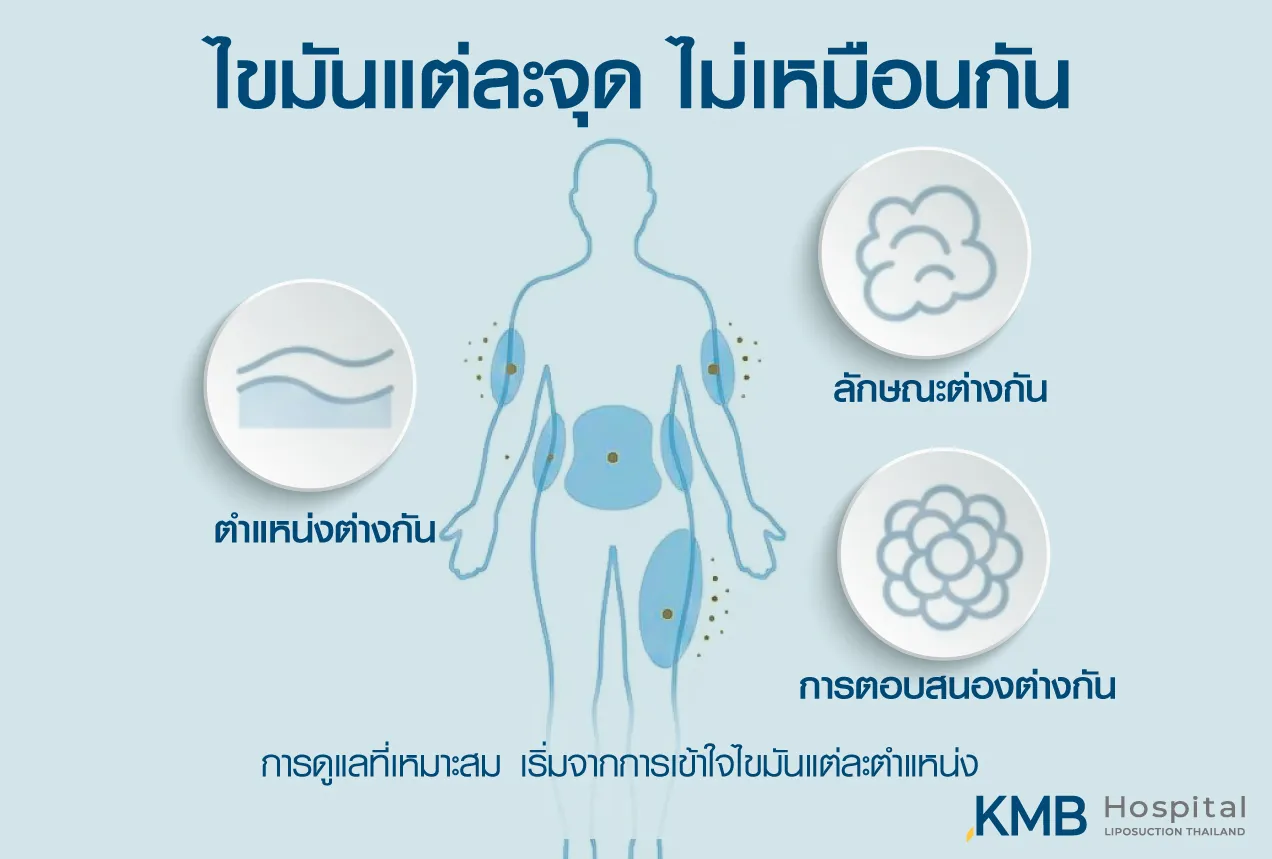 Infographic showing different fat distribution across body areas