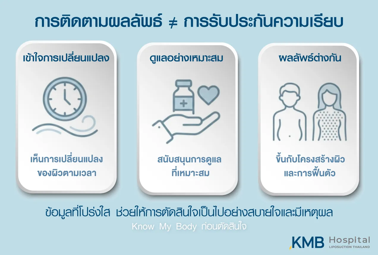 ภาพอินโฟกราฟิก KMB Hospital อธิบายว่าการติดตามผลหลังโปรแกรมดูดไขมันไม่ใช่การรับประกันว่าผิวจะเรียบเหมือนกันทุกคน แต่ช่วยให้เข้าใจการเปลี่ยนแปลงของผิว สนับสนุนการดูแลที่เหมาะสม และประเมินผลตามโครงสร้างผิวและการฟื้นตัวของแต่ละบุคคล
