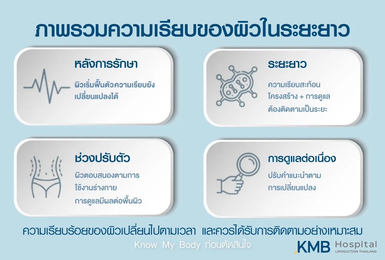 ภาพอินโฟกราฟิก KMB Hospital อธิบายภาพรวมความเรียบของผิวในระยะยาว ตั้งแต่ช่วงหลังการรักษา ช่วงปรับตัว การติดตามเป็นระยะ และการดูแลต่อเนื่อง เพื่อประเมินการเปลี่ยนแปลงของผิวอย่างเหมาะสม