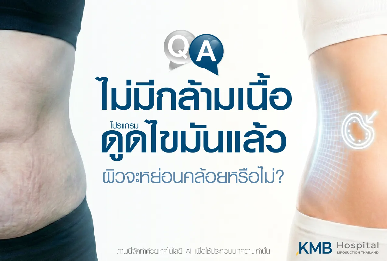 ภาพปกบทความ KMB Hospital เปรียบเทียบลักษณะหน้าท้องก่อนและหลังโปรแกรมดูดไขมัน เพื่ออธิบายว่าหากมวลกล้ามเนื้อน้อย ผิวหลังทำอาจกระชับหรือหย่อนคล้อยแตกต่างกันตามคุณภาพผิวและโครงสร้างร่างกาย