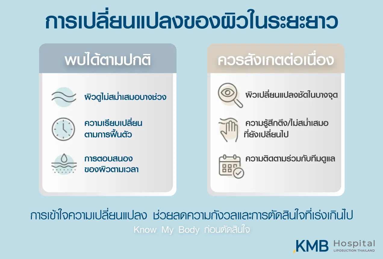ภาพอินโฟกราฟิก KMB Hospital เปรียบเทียบการเปลี่ยนแปลงของผิวที่อาจพบได้ตามปกติกับอาการที่ควรสังเกตต่อเนื่อง เช่น ผิวไม่สม่ำเสมอบางช่วง ความรู้สึกตึงที่เปลี่ยนไป และการเปลี่ยนแปลงชัดในบางจุด