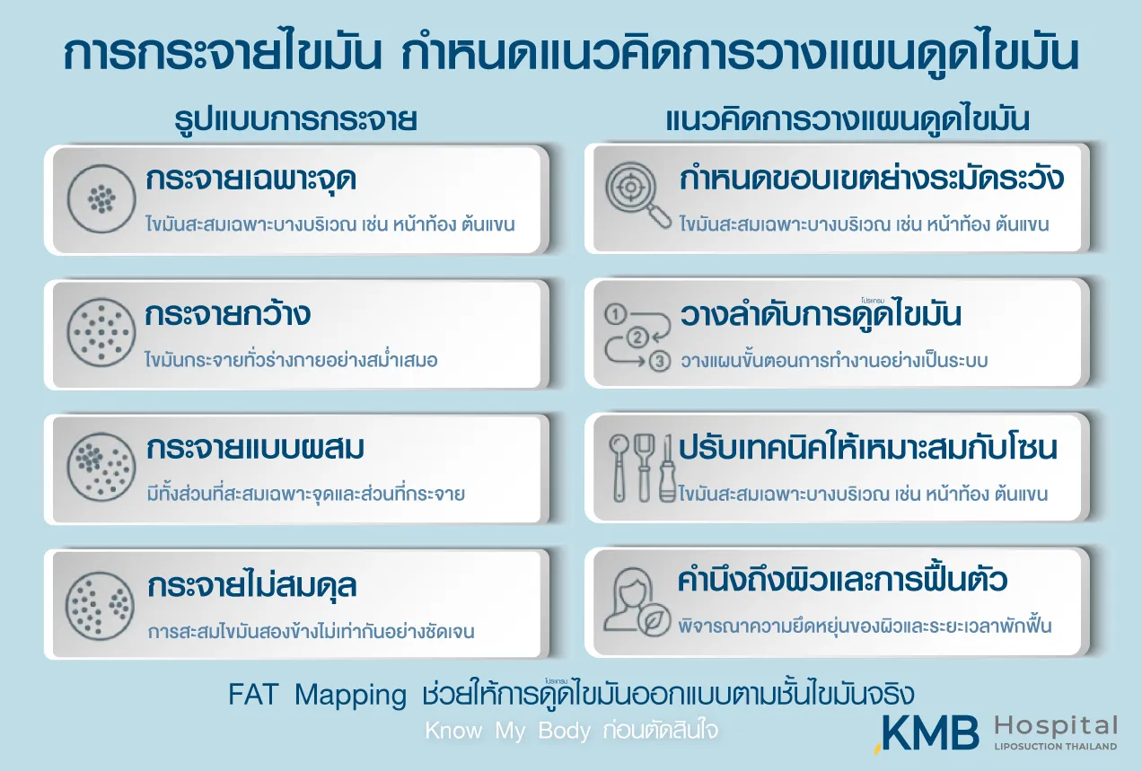 อินโฟกราฟิก KMB Hospital อธิบายว่ารูปแบบการกระจายของไขมัน เช่น กระจายเฉพาะจุด กระจายกว้าง กระจายแบบผสม หรือกระจายไม่สมดุล มีผลต่อการกำหนดขอบเขต ลำดับ เทคนิค และการฟื้นตัวในการวางแผนโปรแกรมดูดไขมัน
