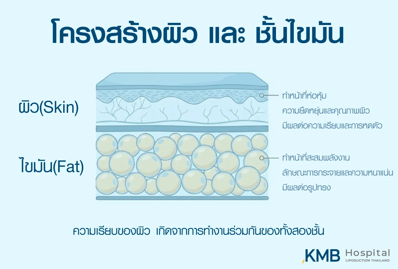อินโฟกราฟิก KMB Hospital แสดงความแตกต่างระหว่างโครงสร้างผิวและชั้นไขมัน โดยอธิบายว่าความยืดหยุ่นและคุณภาพผิวมีผลต่อความเรียบและการหดตัว ส่วนการกระจายและความหนาแน่นของไขมันมีผลต่อรูปทรง