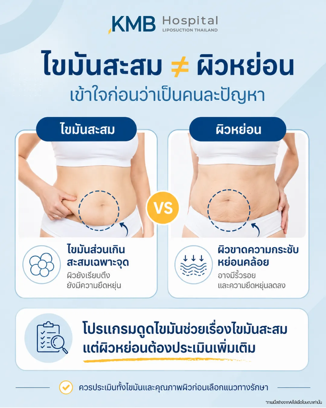 ภาพเปรียบเทียบความแตกต่างระหว่างไขมันสะสมหน้าท้องกับผิวหน้าท้องหย่อนคล้อย เพื่อช่วยให้เข้าใจก่อนประเมินโปรแกรมดูดไขมันและคุณภาพผิว โดย KMB Hospital