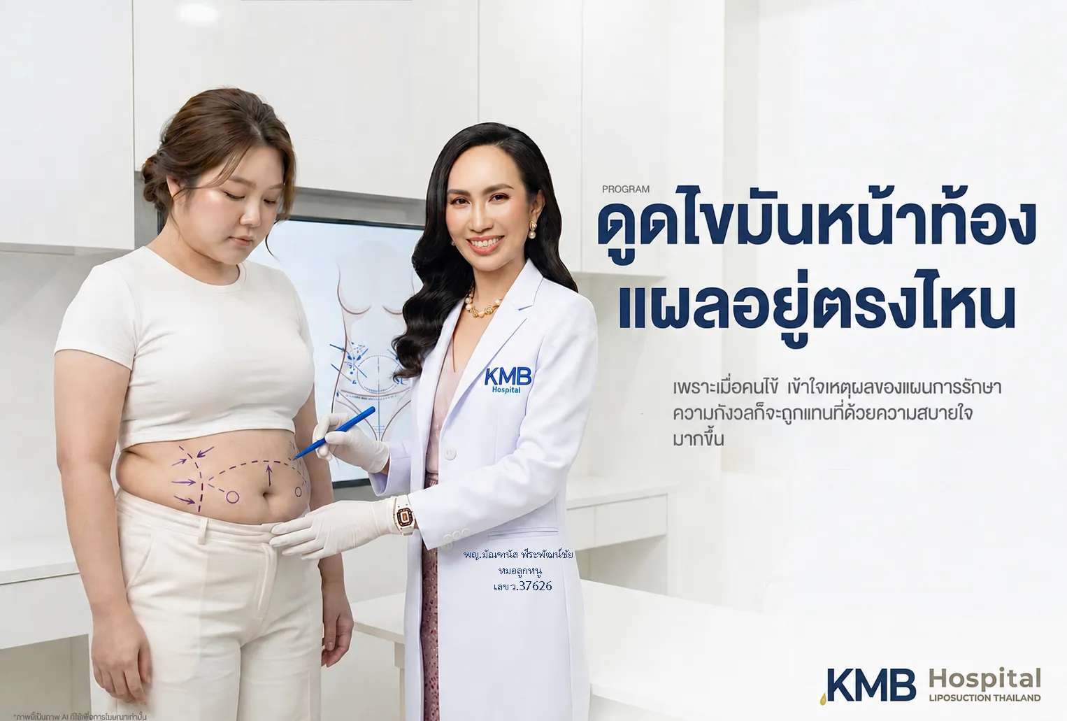 ภาพปกบทความ KMB Hospital แสดงแพทย์ประเมินและทำเครื่องหมายบริเวณหน้าท้องของผู้รับบริการ เพื่ออธิบายตำแหน่งแผลและวางแผนโปรแกรมดูดไขมันหน้าท้องให้เหมาะกับสรีระเฉพาะบุคคล