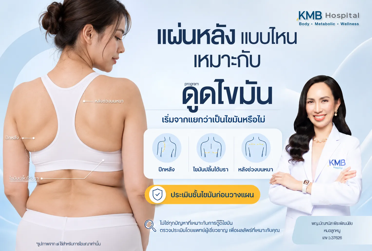 ภาพปกบทความ KMB Hospital อธิบายบริเวณแผ่นหลังที่อาจเหมาะกับโปรแกรมดูดไขมัน ได้แก่ ปีกหลัง ไขมันปลิ้นใต้บรา และหลังช่วงบนหนา พร้อมเน้นการประเมินชั้นไขมันก่อนวางแผนโดยแพทย์