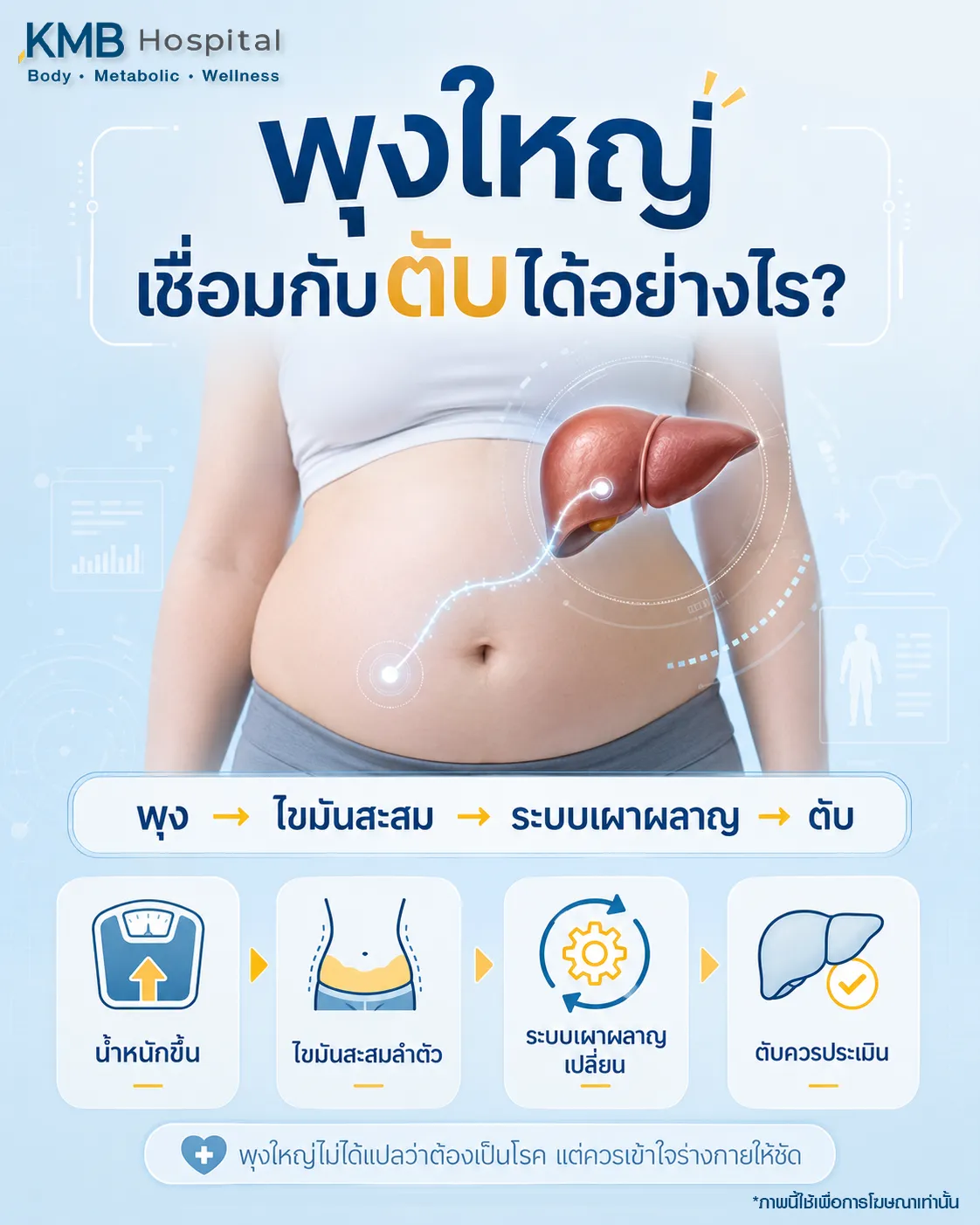 ภาพอินโฟกราฟิก KMB Hospital เรื่องพุงใหญ่เชื่อมกับตับได้อย่างไร แสดงไขมันสะสมบริเวณหน้าท้อง ภาพตับ และลำดับความเกี่ยวข้องระหว่างพุง ไขมันสะสม ระบบเผาผลาญ และสุขภาพตับ
