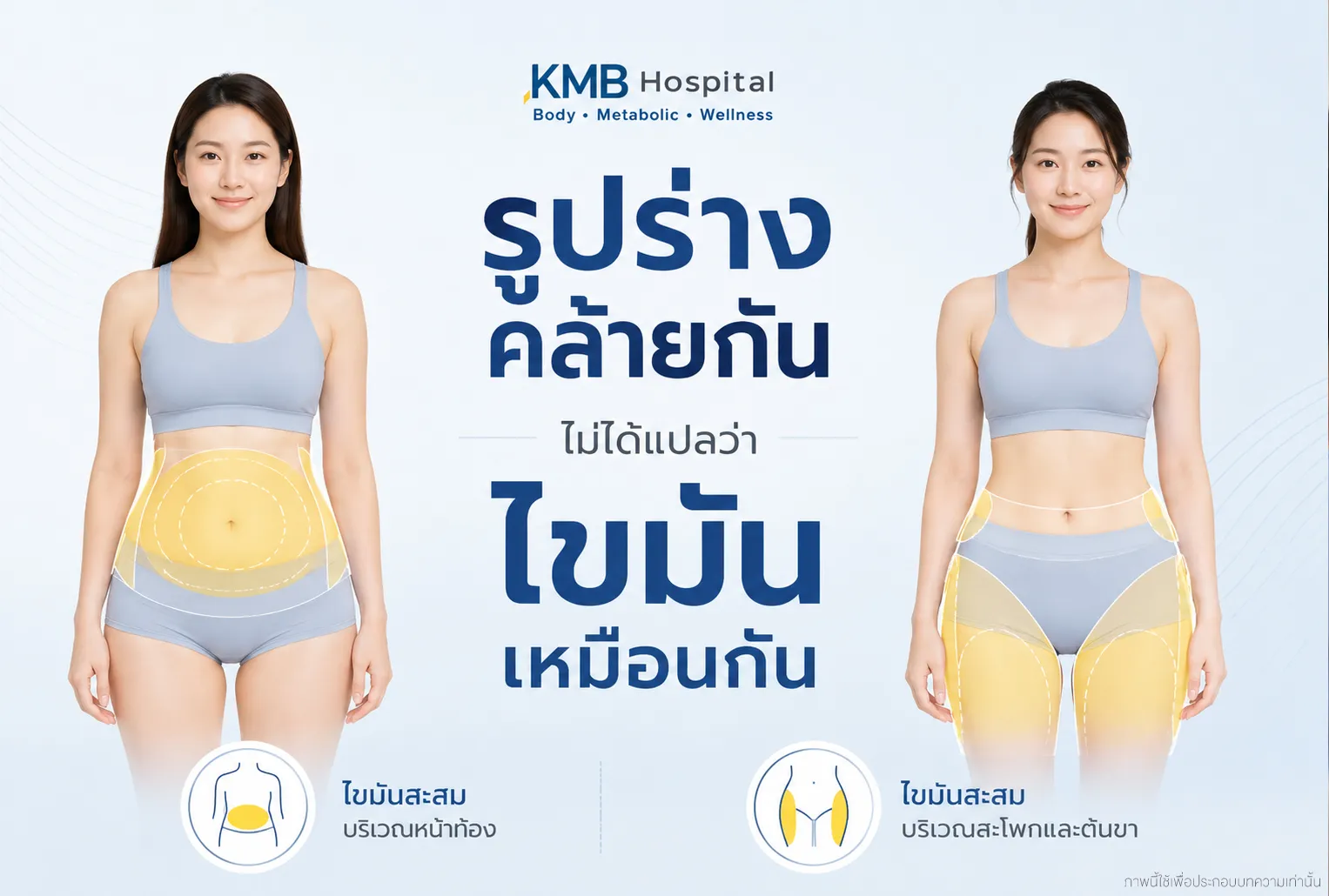 ภาพเปรียบเทียบคนรูปร่างใกล้เคียงกันแต่มีการกระจายตัวของไขมันแตกต่างกัน