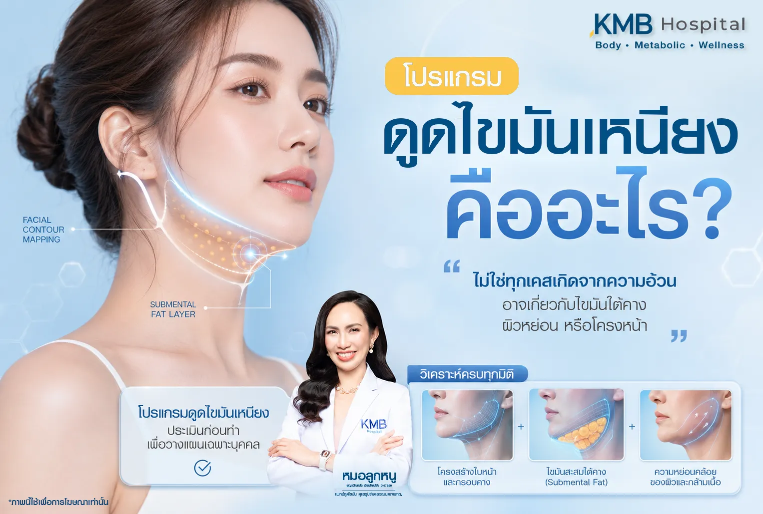 ภาพอินโฟกราฟิก KMB Hospital อธิบายโปรแกรมดูดไขมันเหนียง โดยประเมินไขมันใต้คาง ความหย่อนคล้อยของผิว และโครงสร้างใบหน้า เพื่อวางแผนดูแลเฉพาะบุคคลก่อนทำโปรแกรม