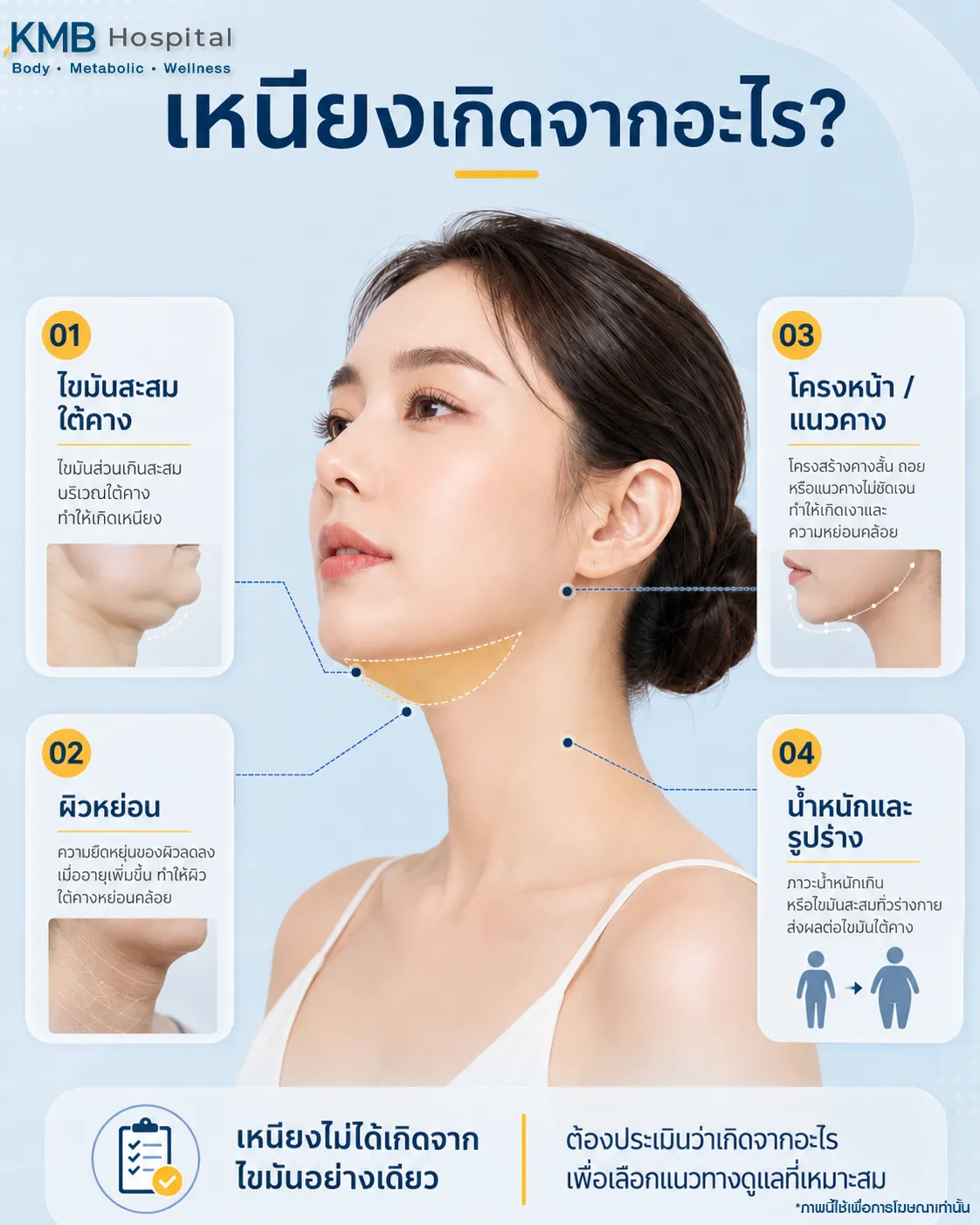 ภาพอินโฟกราฟิก KMB Hospital อธิบายสาเหตุของเหนียง ได้แก่ ไขมันสะสมใต้คาง ผิวหย่อน โครงหน้าและแนวคาง รวมถึงน้ำหนักและรูปร่าง พร้อมแนะนำให้ประเมินสาเหตุก่อนเลือกแนวทางดูแล