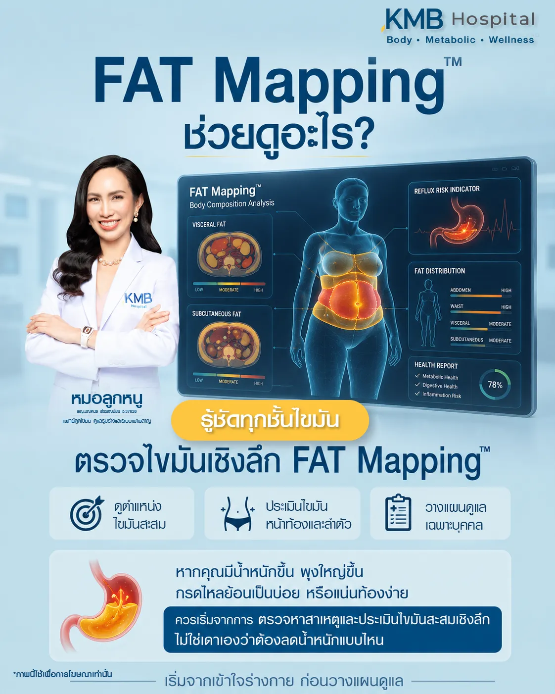 ภาพอินโฟกราฟิก KMB Hospital อธิบายว่า FAT Mapping ช่วยตรวจไขมันเชิงลึก วิเคราะห์ไขมันหน้าท้องและลำตัว ดูตำแหน่งไขมันสะสม และช่วยวางแผนดูแลเฉพาะบุคคลในผู้ที่มีน้ำหนักขึ้น พุงใหญ่ หรือกรดไหลย้อนบ่อย