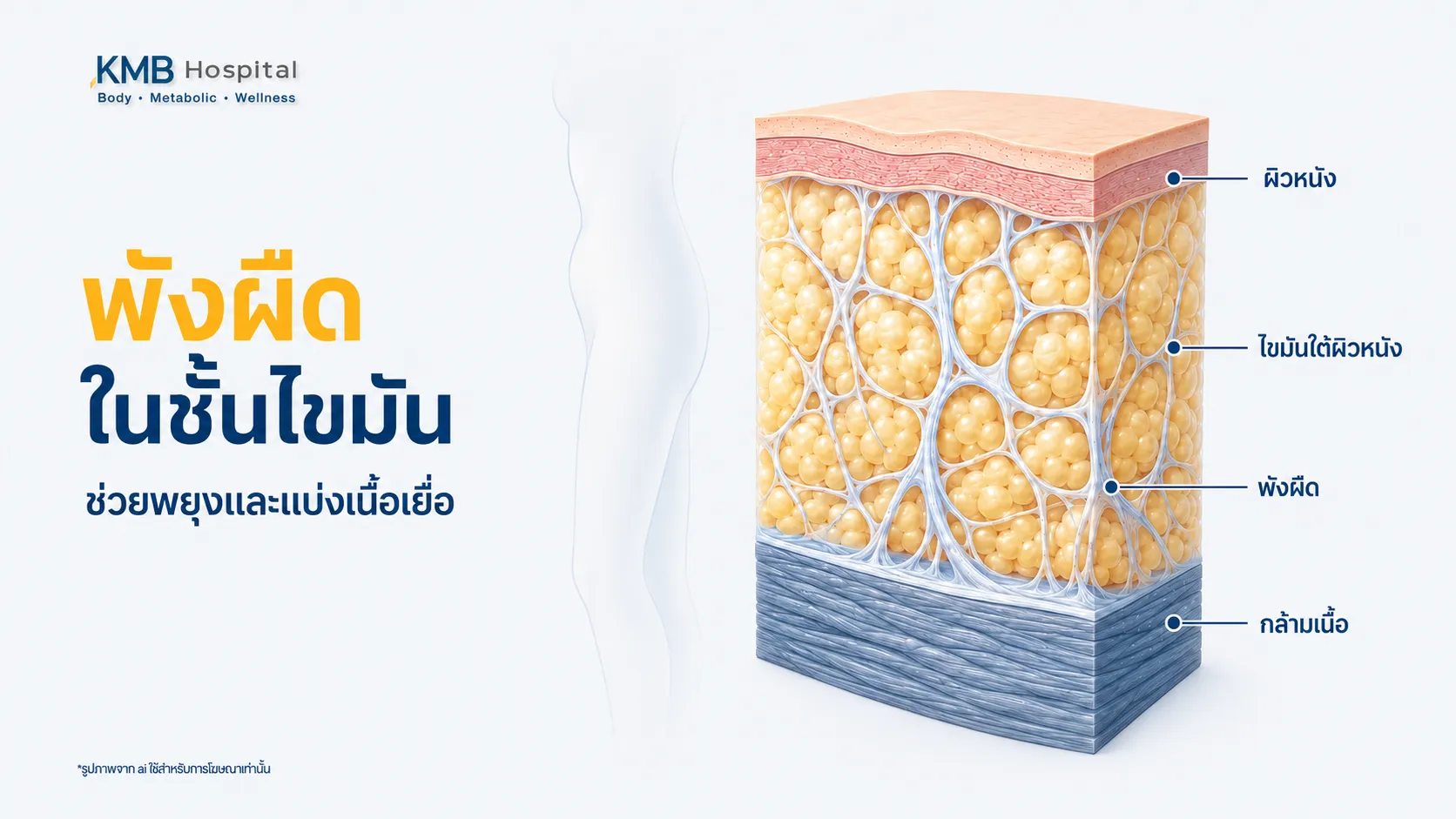 ภาพตัดขวางแสดงเส้นใยพังผืดที่แทรกอยู่ในไขมันใต้ผิวหนังและช่วยแบ่งเนื้อเยื่อออกเป็นกลุ่มก่อนการประเมินดูดไขมัน