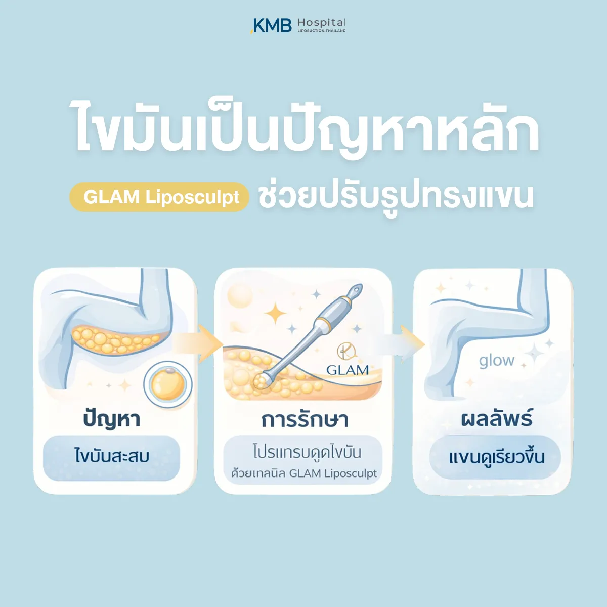 อินโฟกราฟิก KMB Hospital แสดงแนวทางใช้โปรแกรม GLAM Liposculpt สำหรับไขมันสะสมบริเวณต้นแขน ตั้งแต่ปัญหาไขมันสะสม การดูแลด้วยโปรแกรมดูดไขมัน ไปจนถึงการช่วยปรับรูปทรงแขนให้ดูเรียวขึ้น