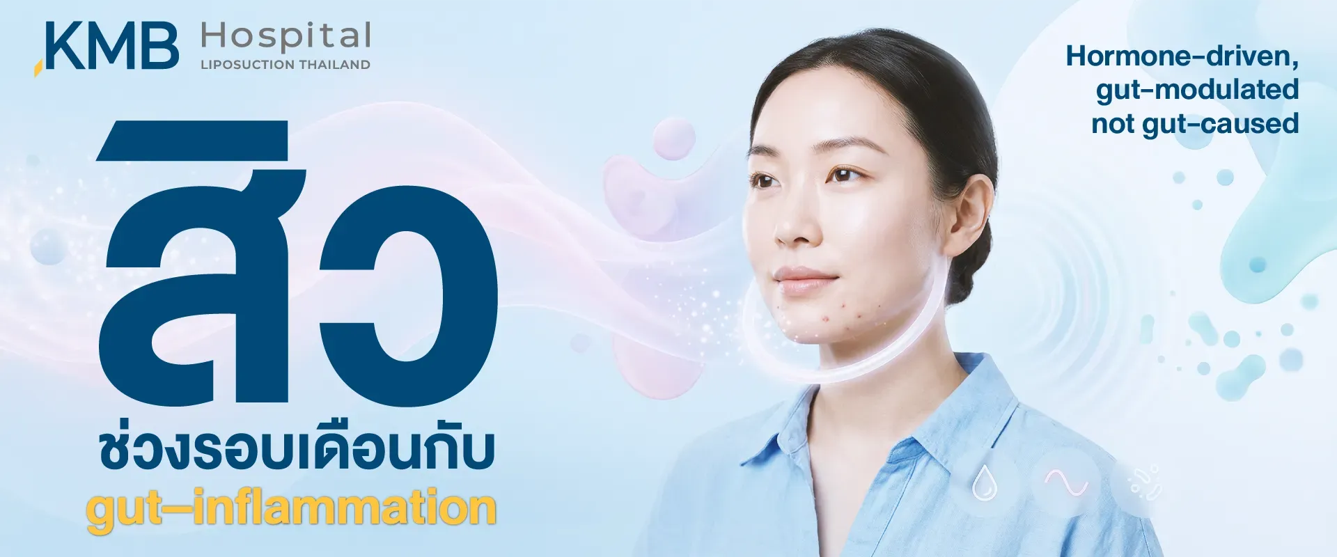 ผู้หญิงมีสิวบริเวณคางช่วงรอบเดือน พร้อมกราฟิกสื่อถึงการเปลี่ยนแปลงของฮอร์โมนและ Gut–Inflammation อธิบายว่าสิวมีฮอร์โมนเป็นปัจจัยหลัก ขณะที่ภาวะลำไส้และการอักเสบอาจมีส่วนปรับความรุนแรง แต่ไม่ใช่สาเหตุโดยตรง