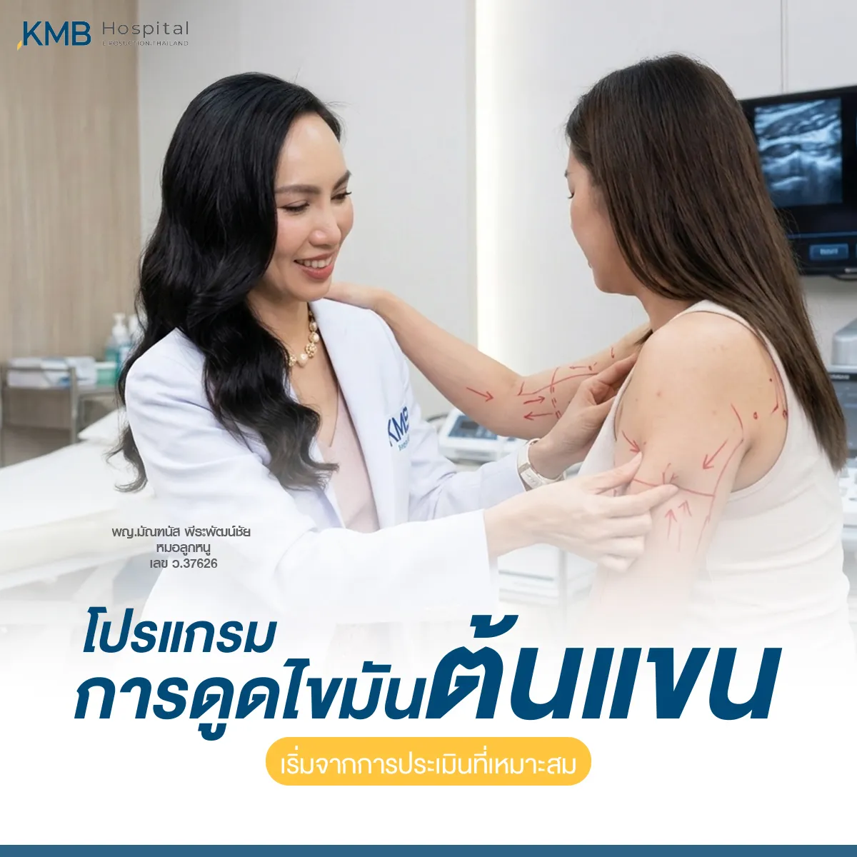ภาพแพทย์ KMB Hospital ประเมินและวางแนวทางโปรแกรมดูดไขมันต้นแขนจากโครงสร้างแขน ตำแหน่งไขมัน และสภาพผิวของผู้รับบริการ เพื่อวางแผนดูแลเฉพาะบุคคล