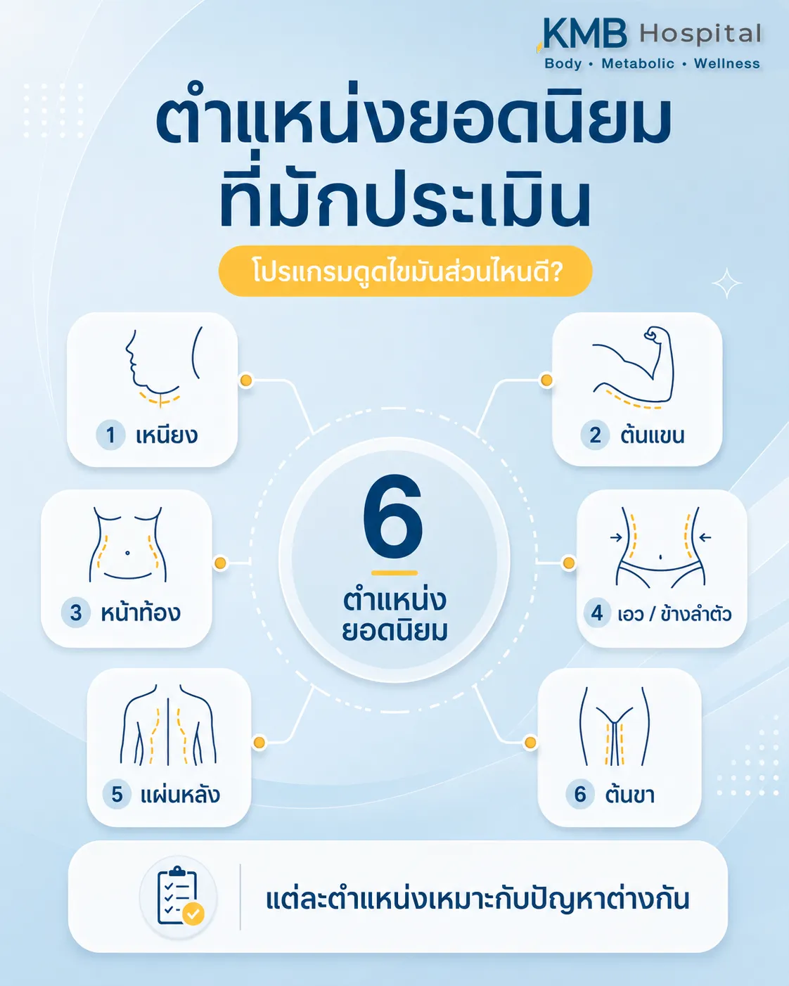 อินโฟกราฟิก KMB Hospital รวม 6 ตำแหน่งยอดนิยมสำหรับโปรแกรมดูดไขมัน ได้แก่ เหนียง ต้นแขน หน้าท้อง เอวหรือข้างลำตัว แผ่นหลัง และต้นขา โดยแต่ละตำแหน่งเหมาะกับปัญหาและโครงสร้างร่างกายที่แตกต่างกัน