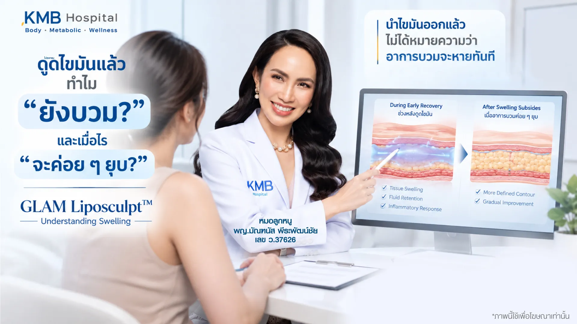 หมอลูกหนูอธิบายสาเหตุของอาการบวมในช่วงฟื้นตัวหลังดูดไขมันแบบ GLAM Liposculpt™