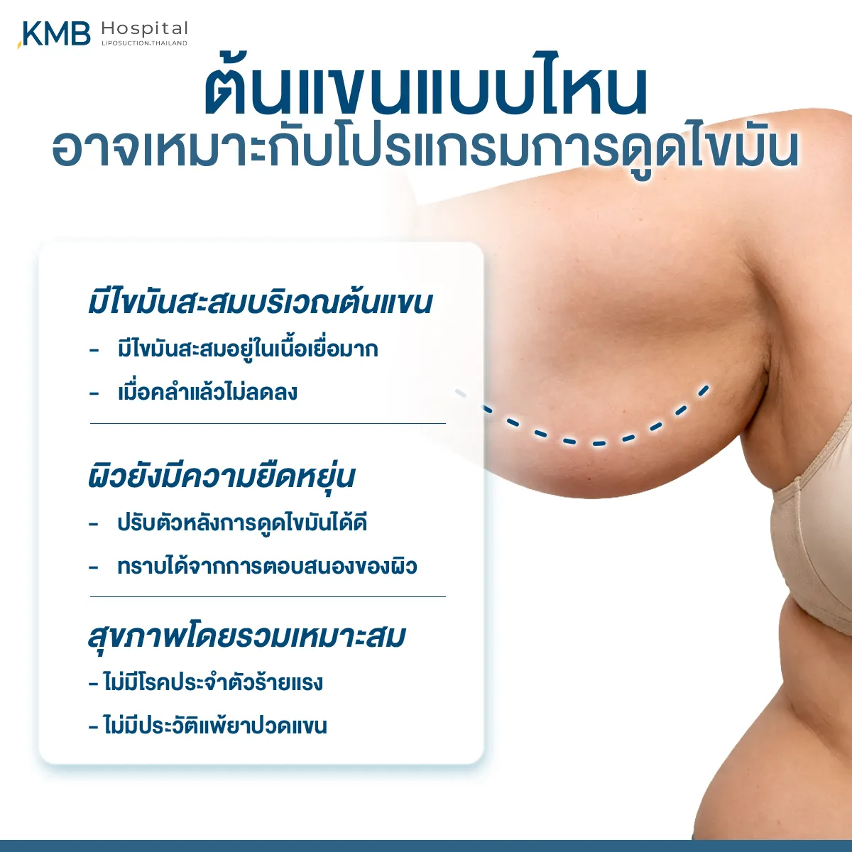อินโฟกราฟิก KMB Hospital อธิบายลักษณะต้นแขนที่อาจเหมาะกับโปรแกรมดูดไขมัน ได้แก่ มีไขมันสะสมบริเวณต้นแขน ผิวยังมีความยืดหยุ่น และสุขภาพโดยรวมเหมาะสม
