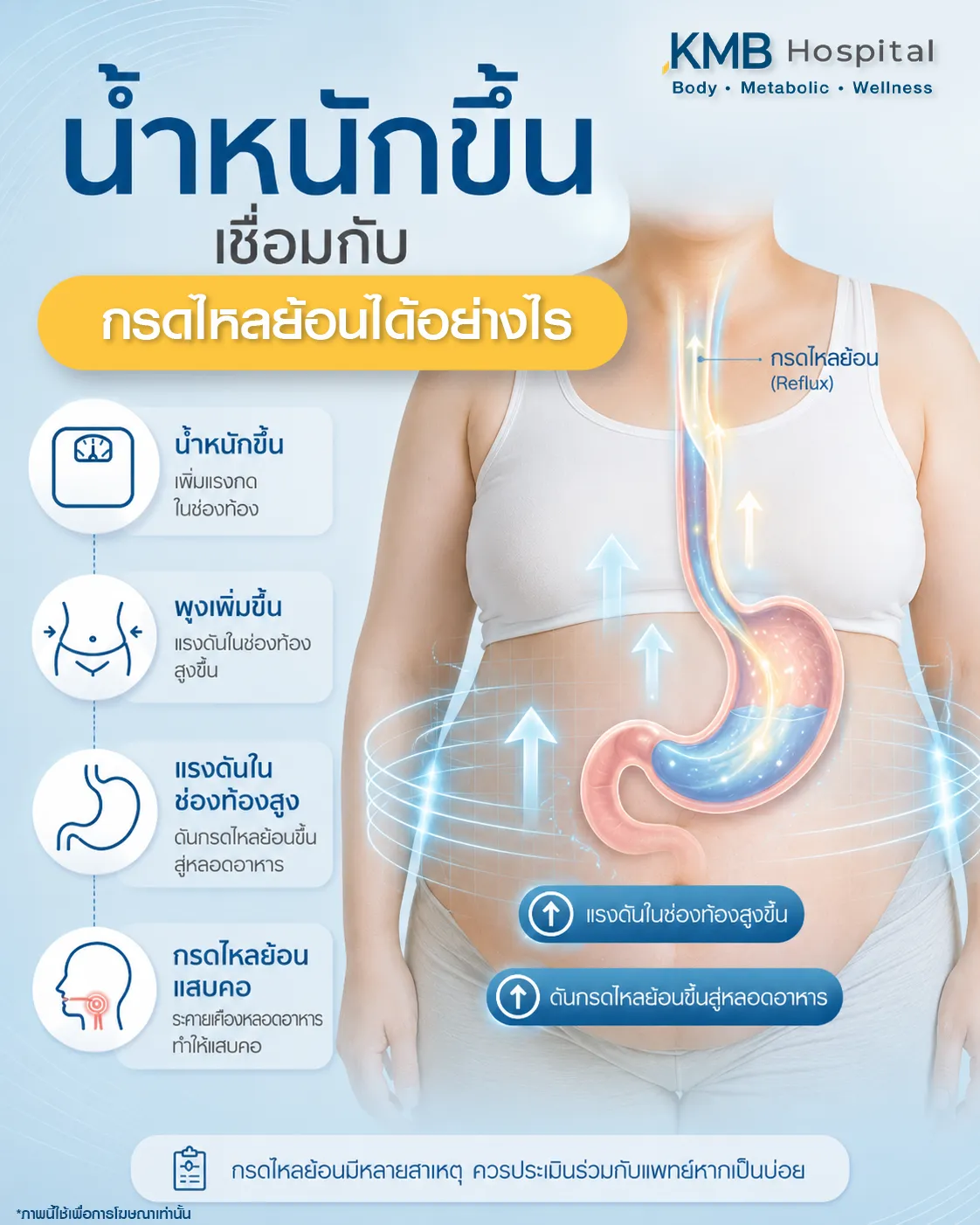 ภาพอินโฟกราฟิก KMB Hospital เรื่องน้ำหนักขึ้นเชื่อมกับกรดไหลย้อนได้อย่างไร แสดงลำดับจากน้ำหนักขึ้น พุงเพิ่มขึ้น แรงดันในช่องท้องสูงขึ้น และอาจดันกรดไหลย้อนขึ้นสู่หลอดอาหาร