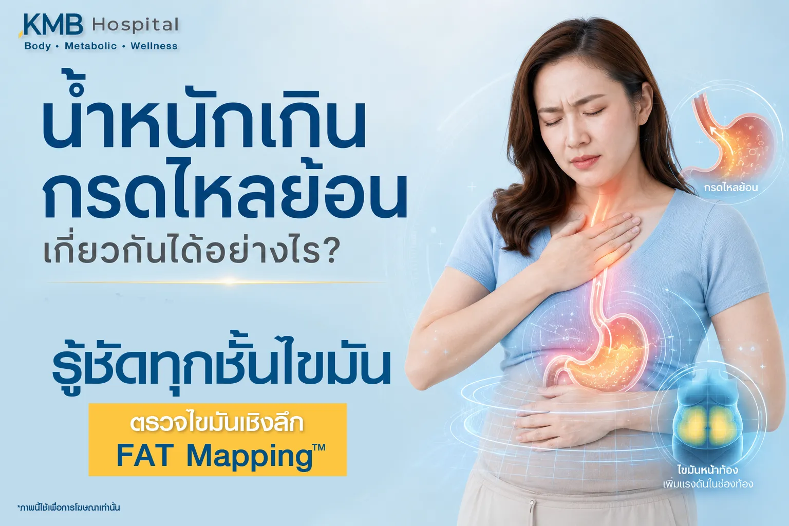 ภาพประกอบบทความ KMB Hospital เรื่องน้ำหนักเกินกับกรดไหลย้อน แสดงผู้หญิงมีอาการแสบร้อนบริเวณหน้าอกและกระเพาะ พร้อมสื่อถึงไขมันหน้าท้องที่อาจเพิ่มแรงดันในช่องท้อง และการตรวจไขมันเชิงลึกด้วย FAT Mapping