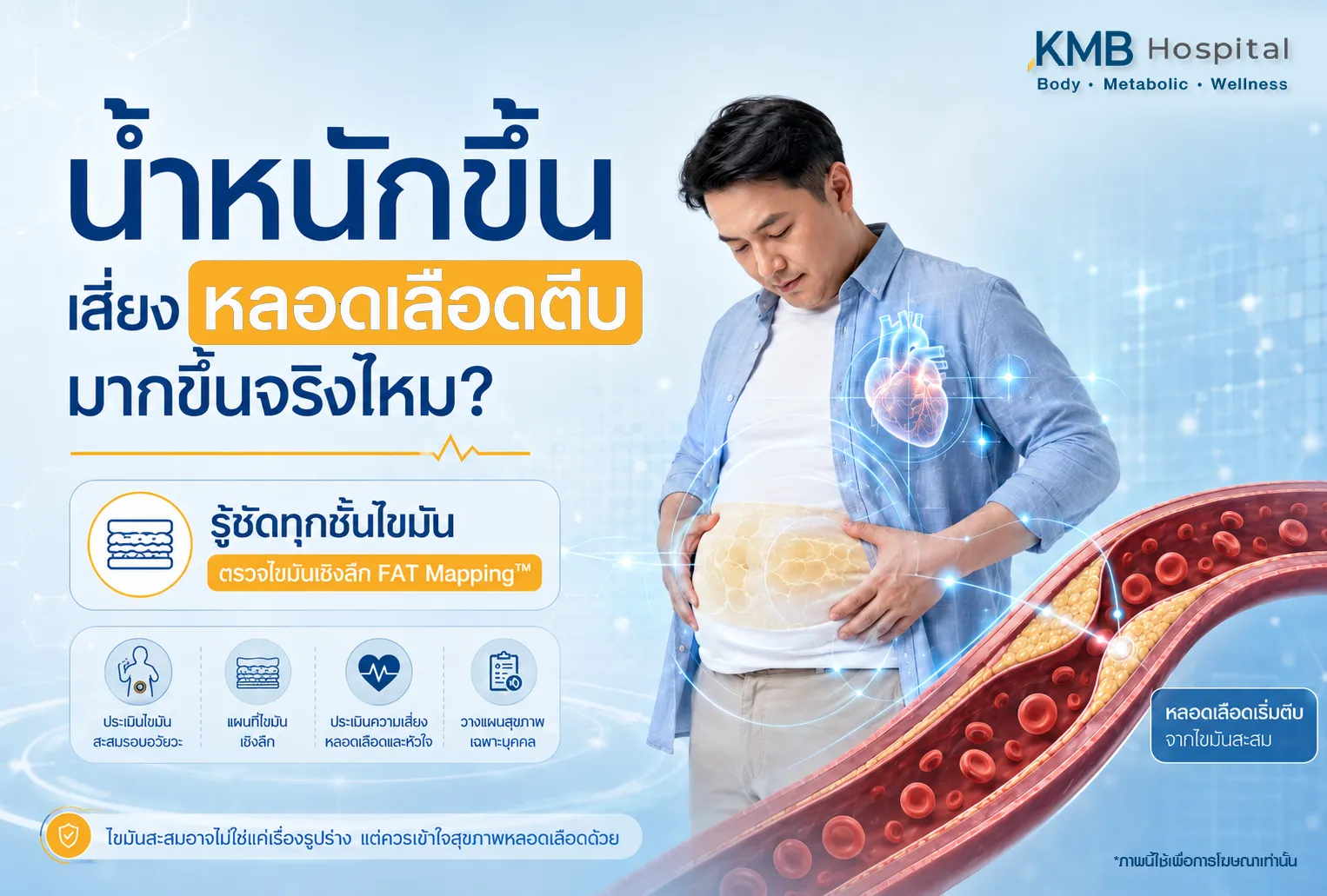 ภาพประกอบบทความ KMB Hospital เรื่องน้ำหนักขึ้นกับความเสี่ยงหลอดเลือดตีบ แสดงผู้ชายมีไขมันสะสมบริเวณหน้าท้อง ภาพหลอดเลือดมีไขมันสะสม และการตรวจไขมันเชิงลึกด้วย FAT Mapping เพื่อประเมินชั้นไขมันและความเสี่ยงด้านหัวใจและหลอดเลือด