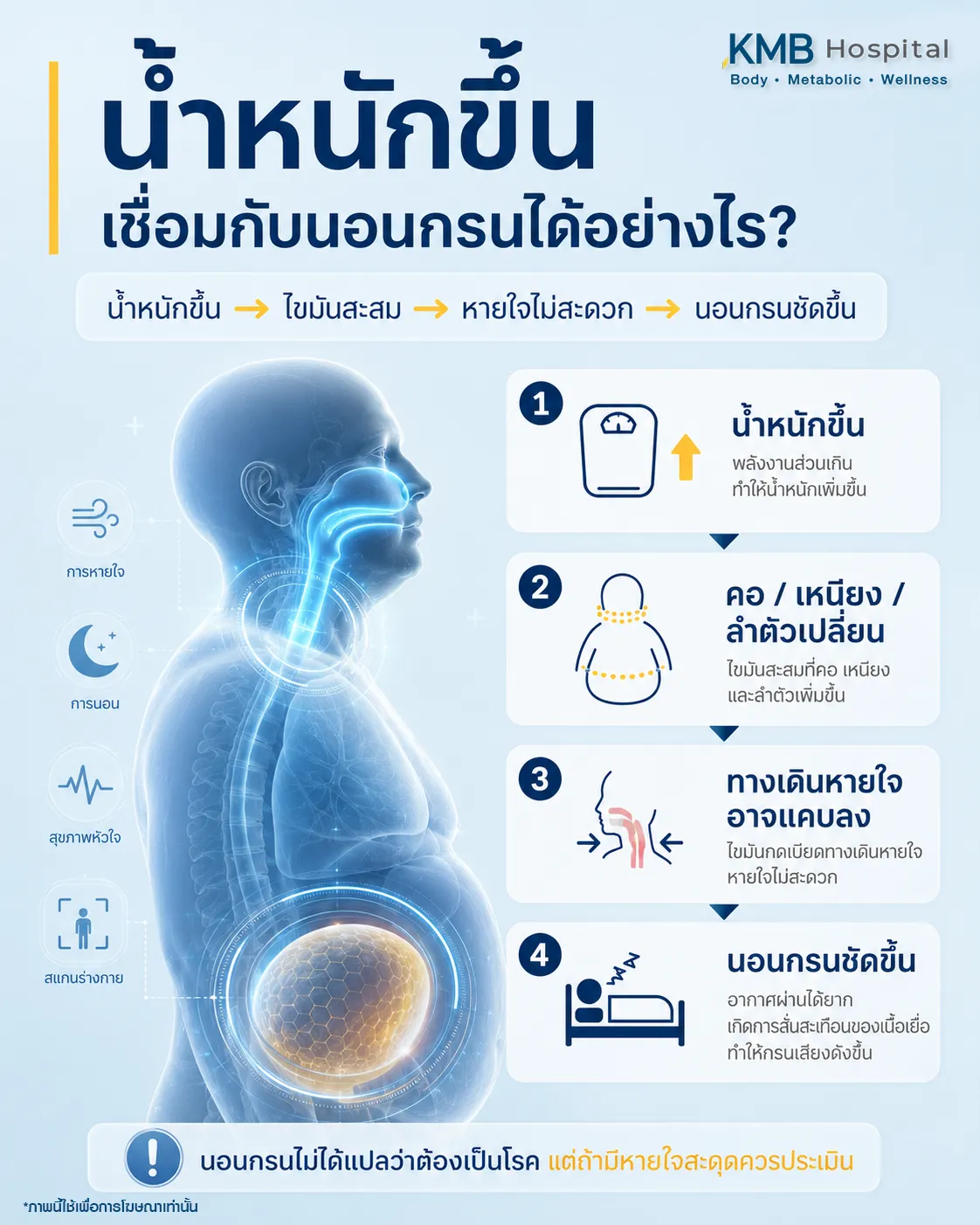 ภาพอินโฟกราฟิก KMB Hospital เรื่องน้ำหนักขึ้นเชื่อมกับนอนกรนได้อย่างไร อธิบายลำดับจากน้ำหนักขึ้น ไขมันสะสม หายใจไม่สะดวก และนอนกรนชัดขึ้น พร้อมแนะนำให้ประเมินเพิ่มเติมหากมีอาการหายใจสะดุด